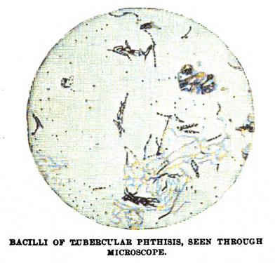 BACILLI OF TUBERCULAR PHTHISIS, SEEN THROUGH MICROSCOPE.
