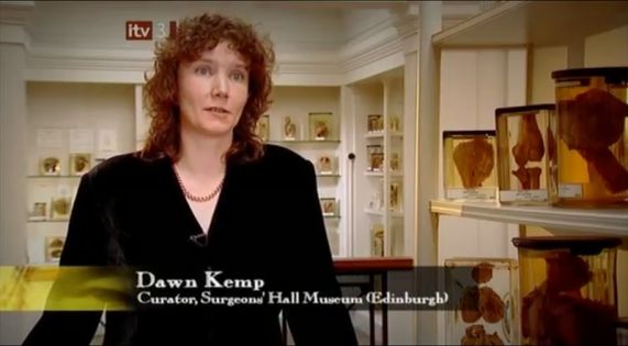 Dawn Kemp